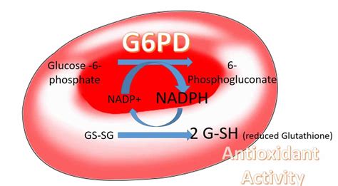 G6PD Deficiency .